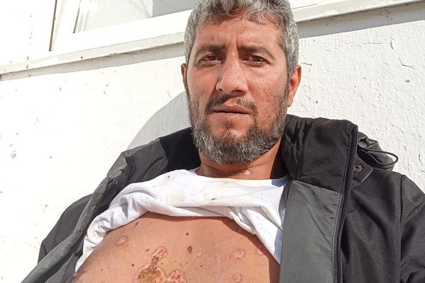 Iranian man says Israel activism led to near-fatal attack by fellow refugees