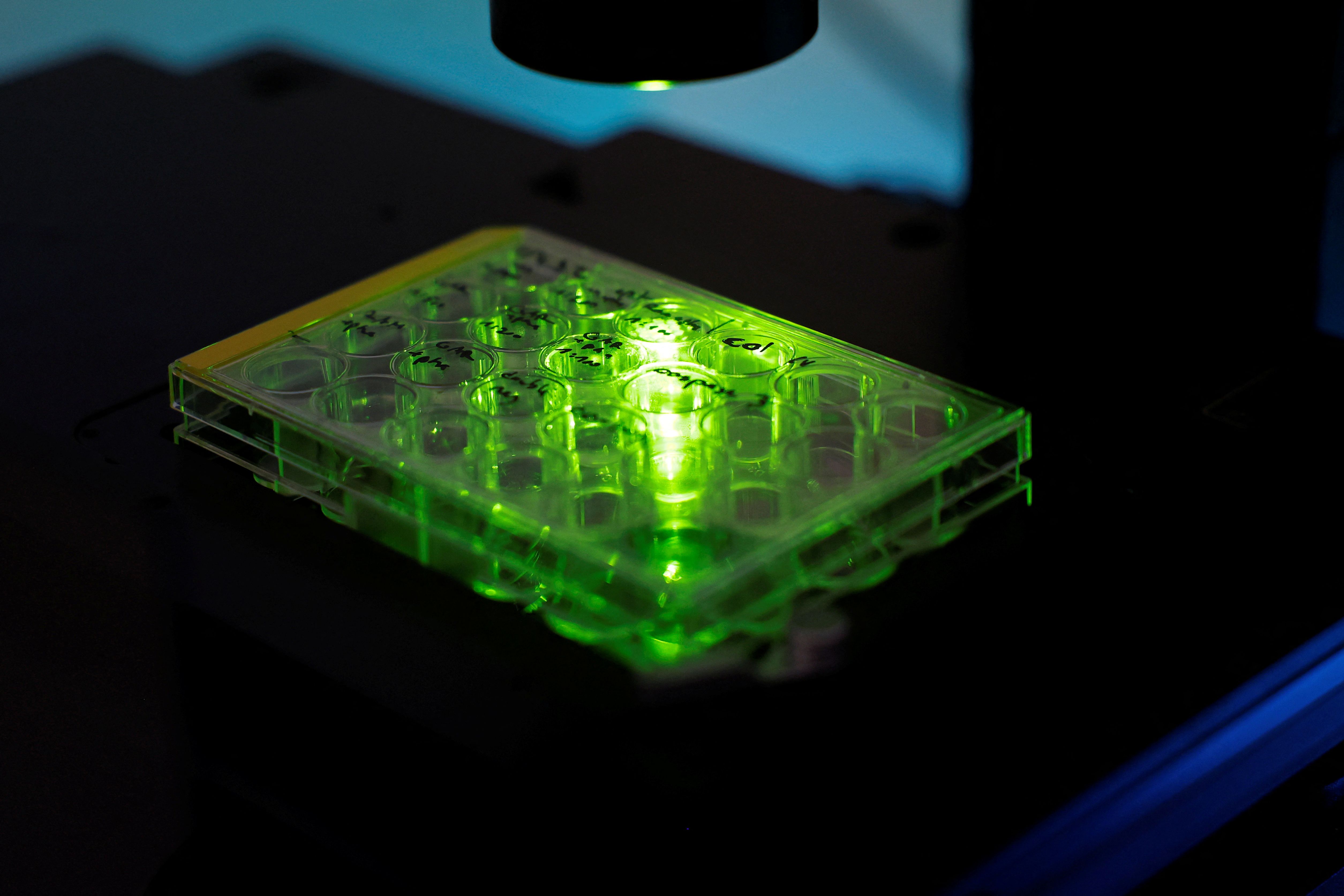 استخراج اسپرم ۳۹ مرد اسرائیلی کشته شده در جنگ حماس به منظور لقاح مصنوعی