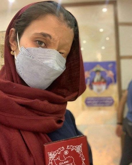 مرضیه ابراهیمی، قربانی اسیدپاشی زنجیرهای در اصفهان، رای داد