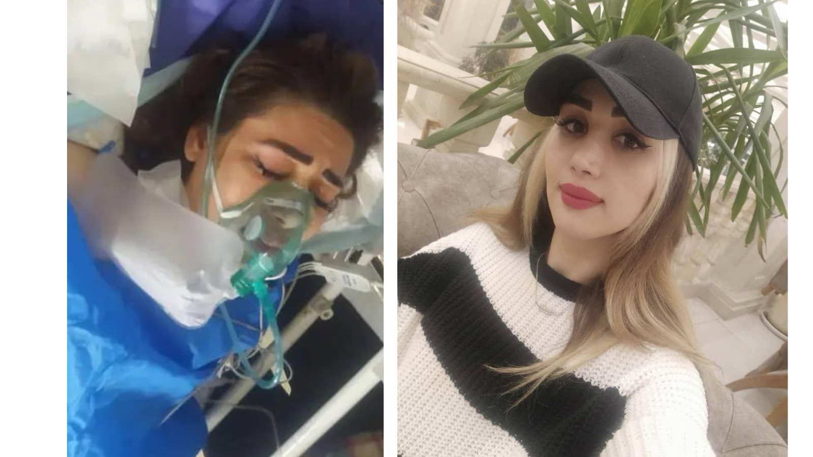 Badri before and after being shot by the police in July