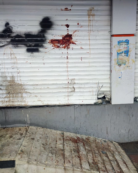 یک پرستار: ماموران برای بردن معترضان حتی وارد آیسییو بیمارستان شدند