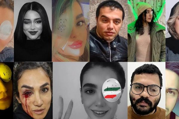 Female Protesters’ Eyes Systematically Targeted: Rights Group