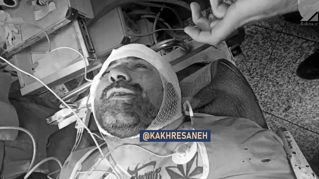 A photo showing Hani Kordeh in hospital after a gang fight