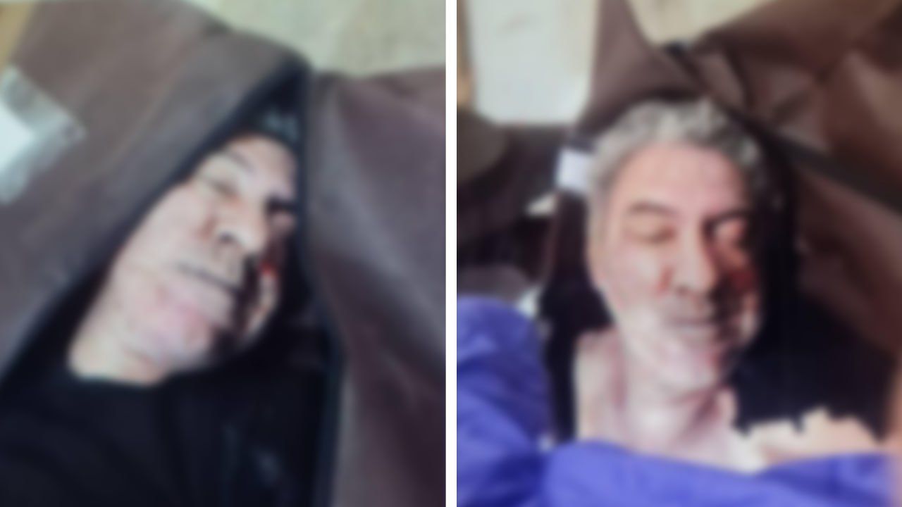 تصاویری اختصاصی حاکی از آثار ضرب و جرح در سر و صورت محمدرضا بالی‌لاشک، معترض کشته‌شده