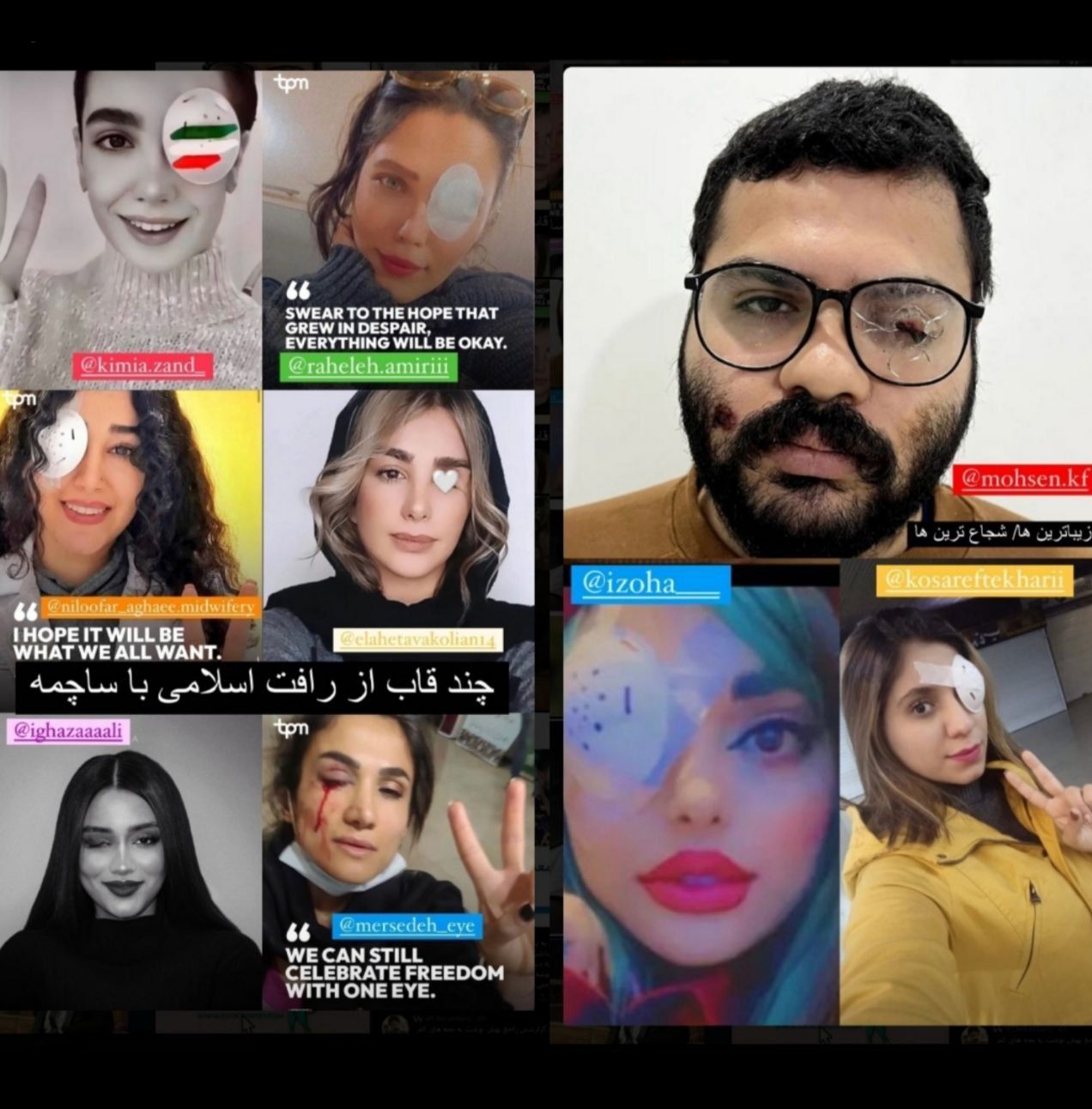 استوری اشکان خطیبی از معترضانی که حکومت نابینایشان کرد؛ «چند قاب از رافت اسلامی با ساچمه»