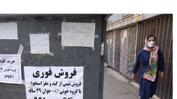 تجارت نیوز: برخی افراد اعضای بدنشان را برای تامین هزینه ازدواج یا بدهی میفروشند