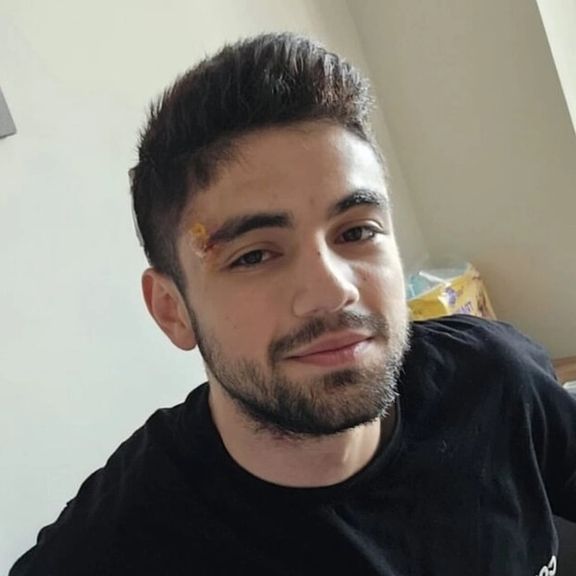 تصادف شدید بردیا سعادت، لژیونر والیبال ایران در آلانیای ترکیه با اتوبوس