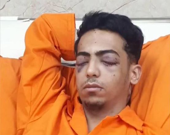 پارسا قبادی، از قربانیان شلیک عامدانه به چشم، بازداشت شد