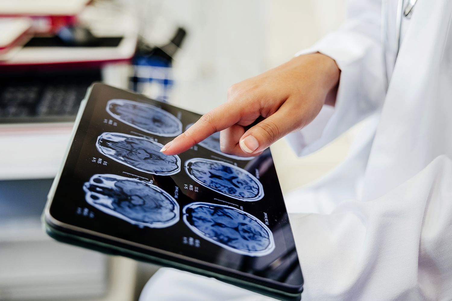 کشف جدید دانشمندان درباره نقش کروموزوم X در مقاومت بالاتر مغز زنان در برابر کهولت سن