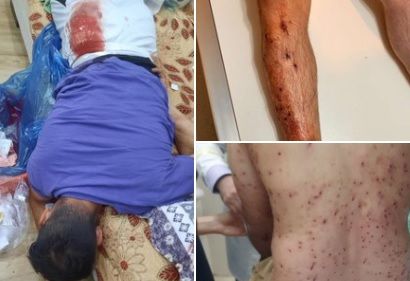 تظاهرات شبانه در آبدانان در اعتراض به مرگ بامشاد سلیمان‌خانی؛ بیش از ۲۰ نفر مجروح شدند