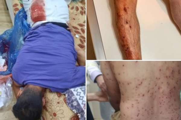 20 Injured In Nighttime Protests In Western Iran