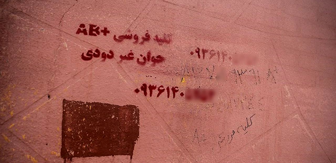 یک مقام انجمن حمایت از بیماران کلیوی: برخی شهروندان برای فروش کلیه خود به عراق می‌روند