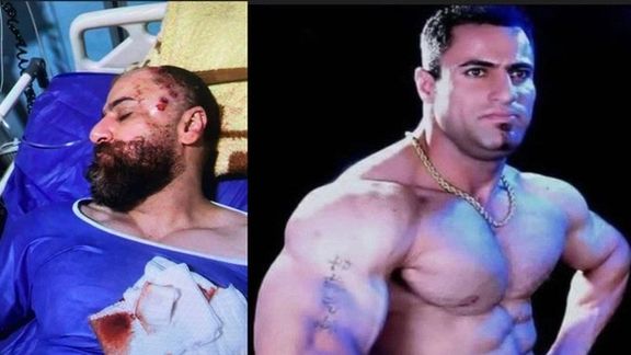 نایب قهرمان پرورشاندام مضروب تازه نیروهای سرکوب