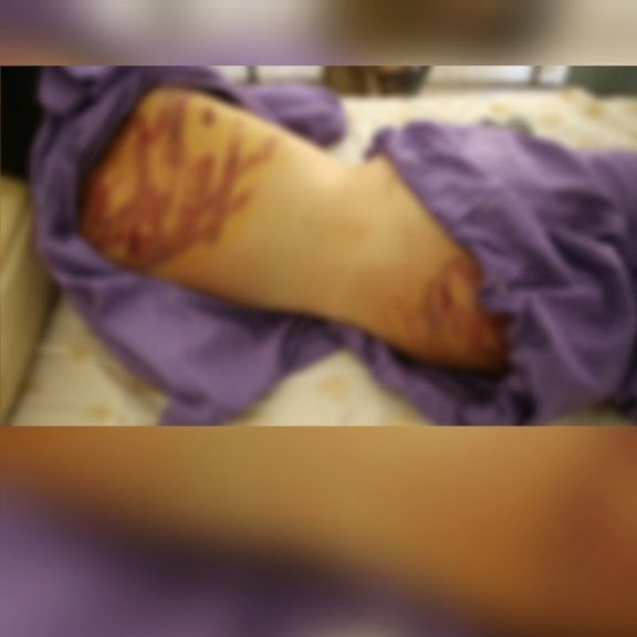 پلیس فاریاب: طالبان کودک ۱۲ ساله را با شلاق شکنجه کرد