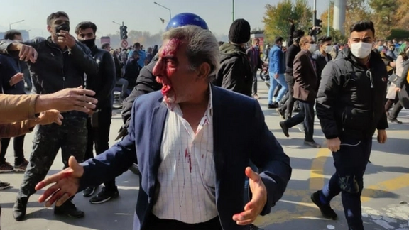 انتقاد سازمان حقوق بشری آرتیکل۱۹ از نقض حق تجمع در ایران و فریبکاری حکومت درباره اعتراضات