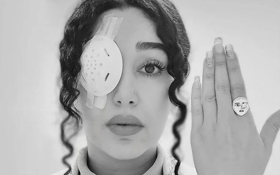 نیلوفر آقایی، معترضی که به چشمش گلوله خورد: ایرانم روی یک چشمم حک شد