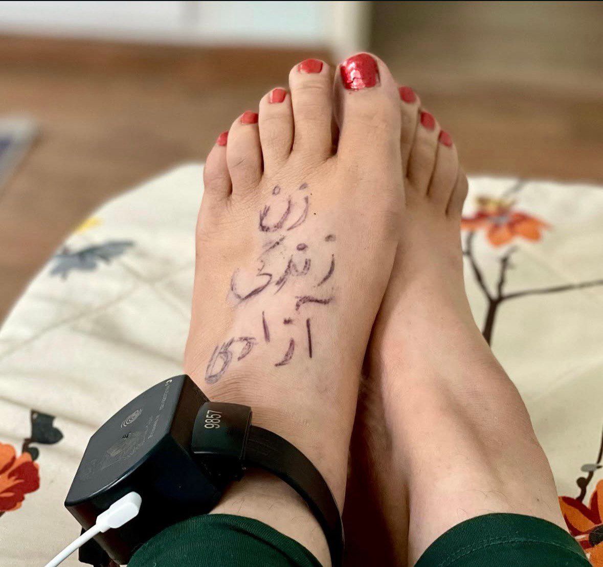 An ankle monitor on an Iranian activist who has written "Woman, Life Freedom" - a slogan of 2022 anti-government protests - on her foot