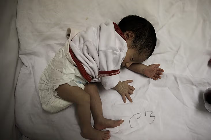 اولین باکتری‌ها در زندگی ما می‌توانند از بیمارستان دور نگاهمان دارند