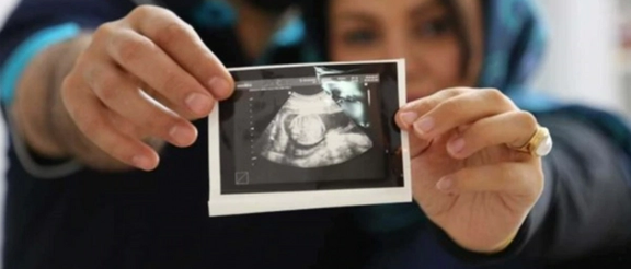 نماینده تبریز: آنهایی که غربالگری جنین را حذف کردند فقط دنبال افزایش جمعیت بودند