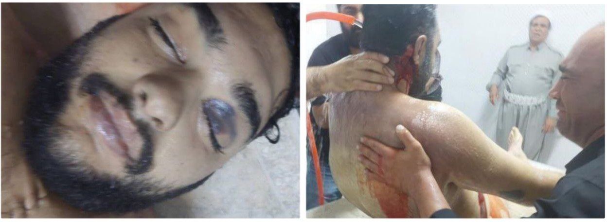 Injuries and bruises on Peyman Galvani's face and head    (July 2023)