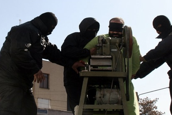 اعلام انزجار انجمن جهانی پزشکی از احتمال اجرای حکم قطع انگشتان دست هشت زندانی در ایران