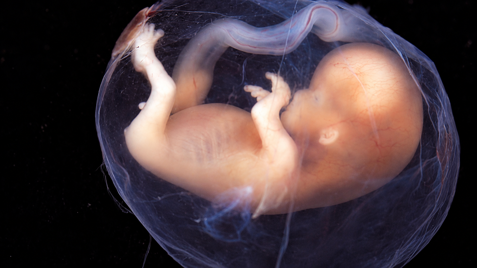 Frozen embryos advertised for sale online in Iran