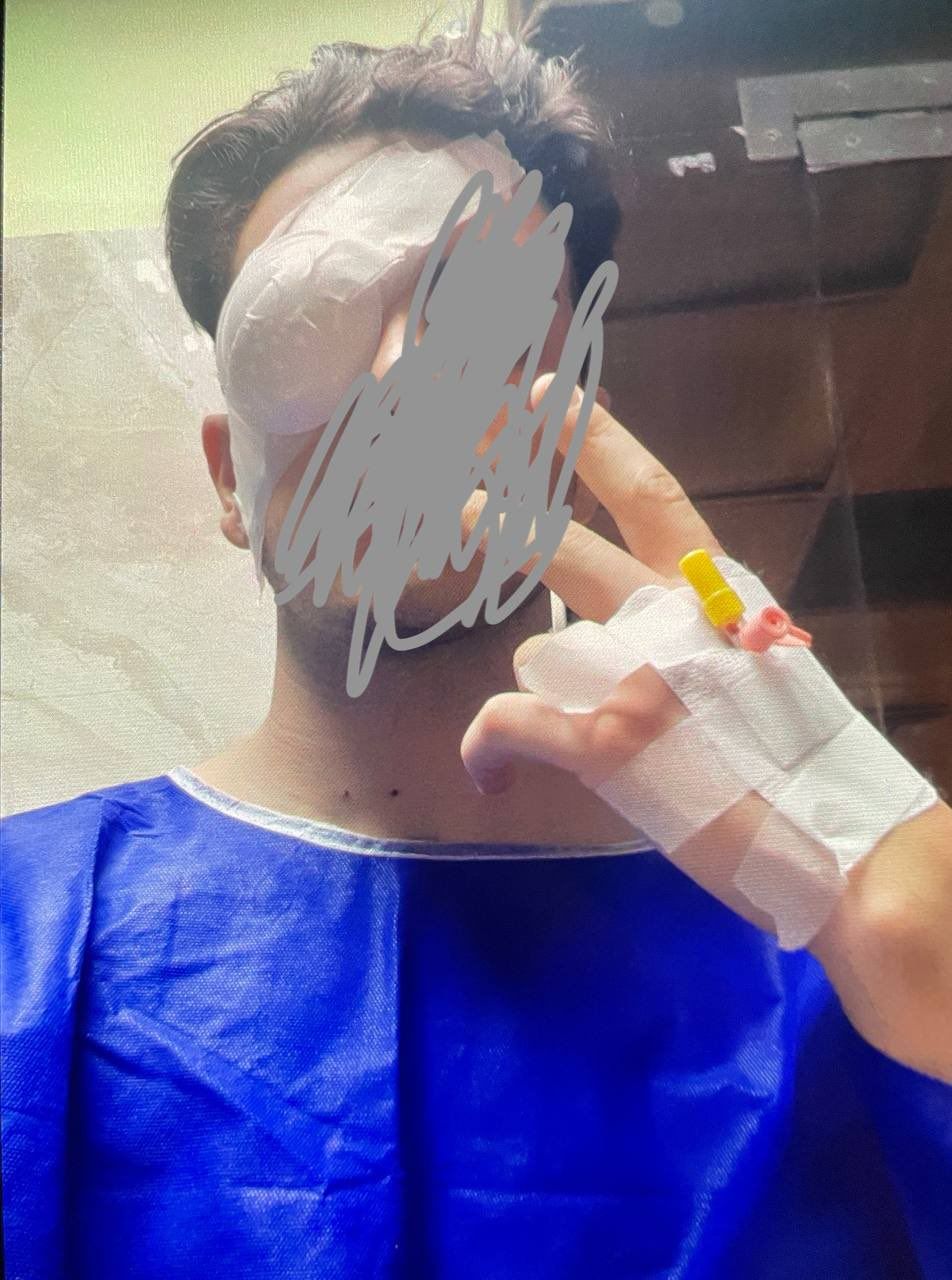 A protester blinded by birdshots  