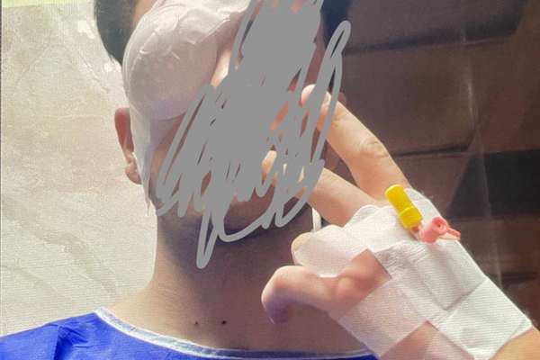 Doctors Say Iran’s Use Of ‘Birdshots’ Blinded Hundreds Of People
