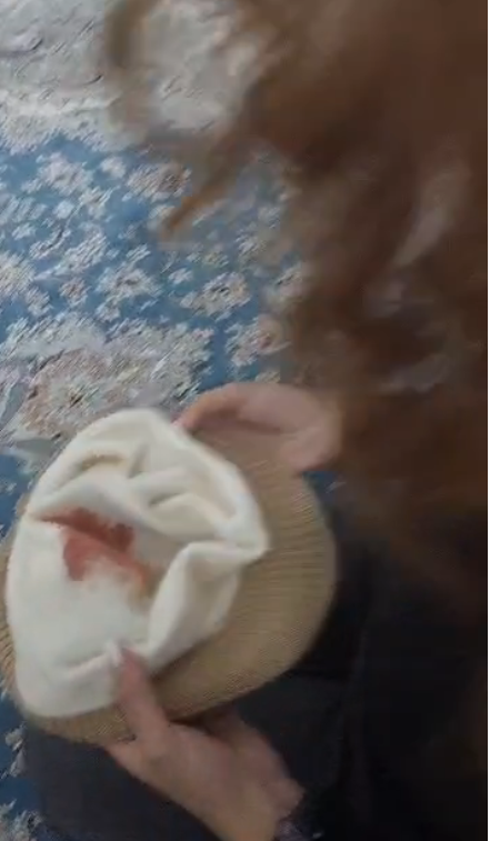 Screenshot of Iranian protester describing being hit on the head and bloodied by baton from Iran's security forces. 