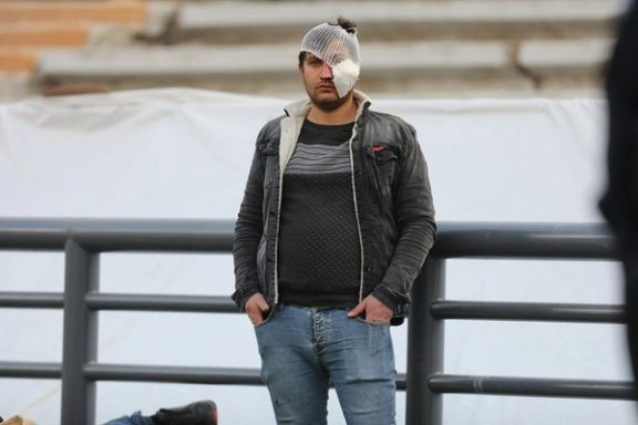 پرسپولیس؛ گوش یک کودک پاره شد، امیدواریم پزشکان چشم یک هوادار را نجات دهند
