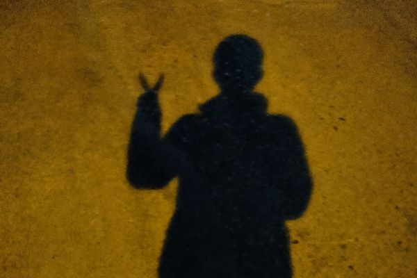 یک پزشک ایرانی از مراجعه بیش از ۶ هزار نفر با آسیب چشمی به کلینیکی در تهران خبر داد