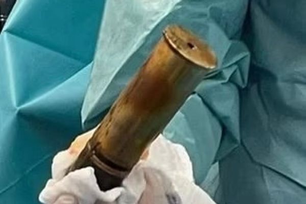 منظمة حقوقية: النظام الإيراني حوّل المستشفيات إلى جزء من آلة القتل والقمع