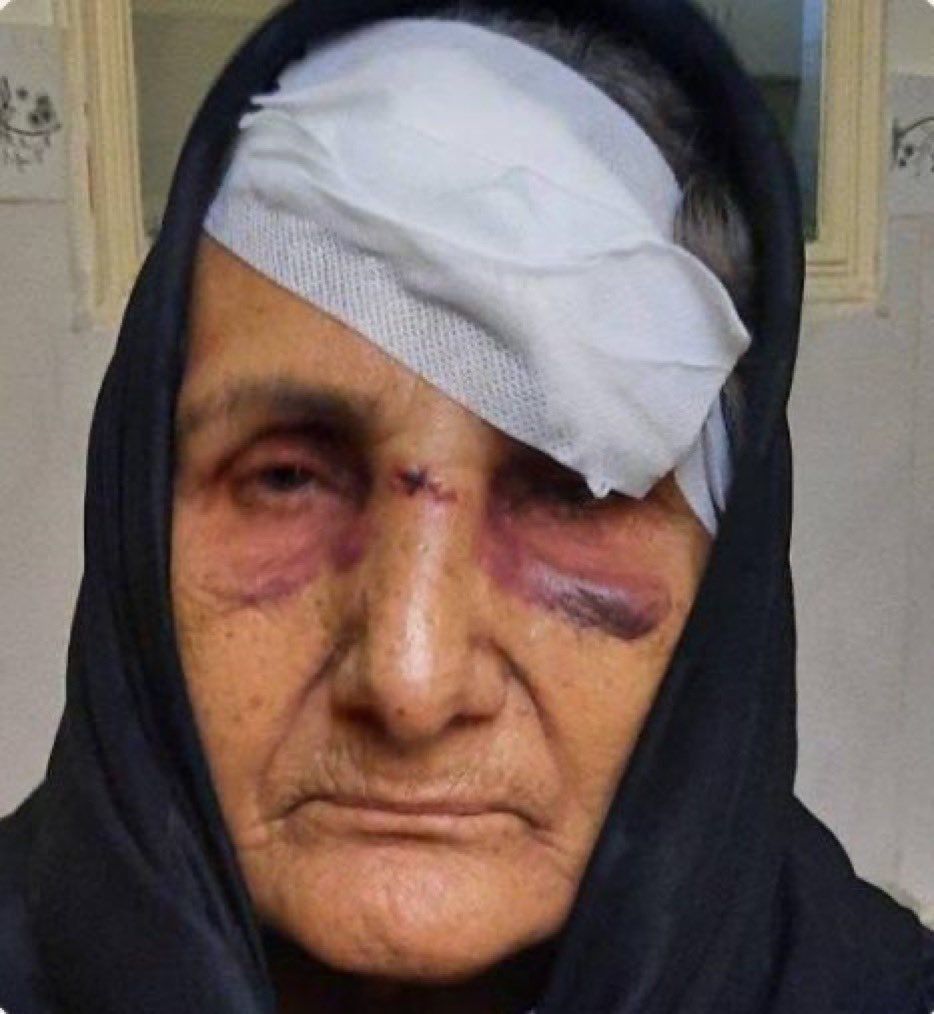 روایت مادر ستار بهشتی از حمله افراد ناشناس به او: پرتم کردند روی میلگردها