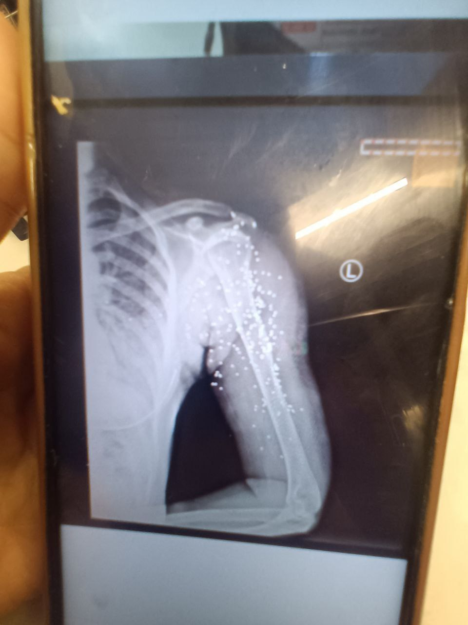 پیام مخاطبان: پرستاران و پزشکان تلاش کردند معترضان قربانی ماموران حکومت نشوند