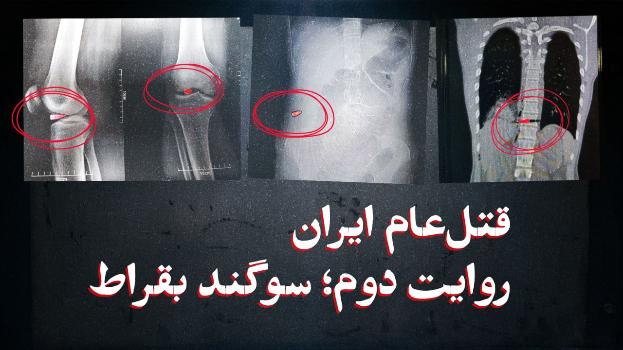 قتل عام ایران؛ سوگند بقراط