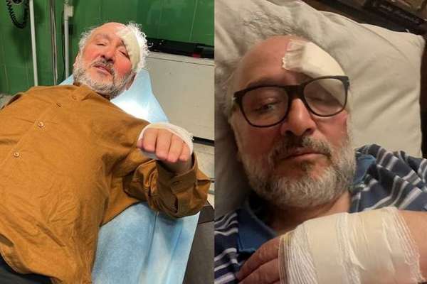 Reformist Politician In Iran Injured During Phone Snatching