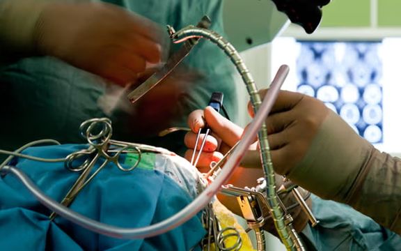 تحولی در جراحی تومورهای مغزی؛ استفاده از تراشه گرافنی برای شناسایی سلولهای سرطانی