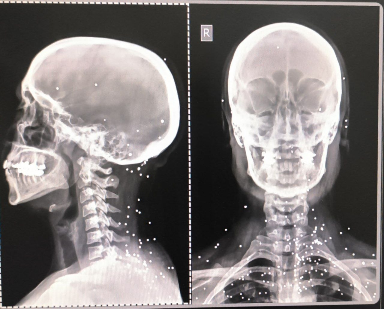 گزارش گاردین از هدف‌گیری عمدی اعضای حیاتی بدن برای سرکوب معترضان در ایران 