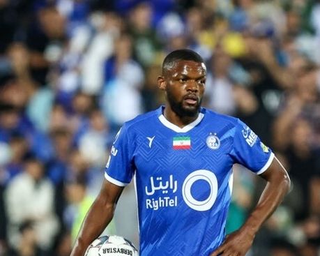 در اثر واردشدن شوک؛ ستاره فرانسوی استقلال بینایی چشم چپ خود را از دست داد