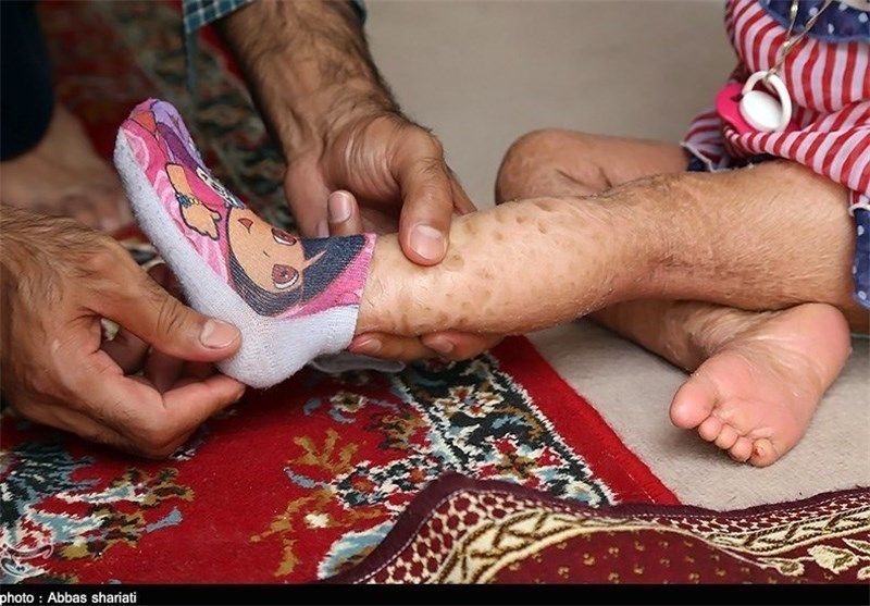 مدیرعامل بنیاد بیماری‌های نادر ایران: داروهای بیماران به موقع تامین نمی‌شود