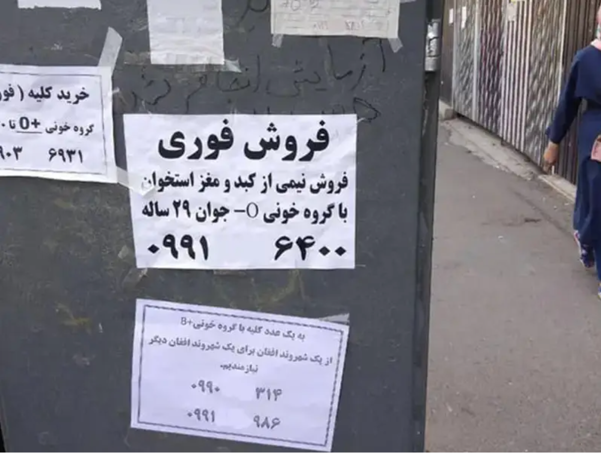 بسعر يبدأ من 3500 دولار .. الشباب والمراهقون في إيران يبيعون الكُلى بسبب الفقر المدقع