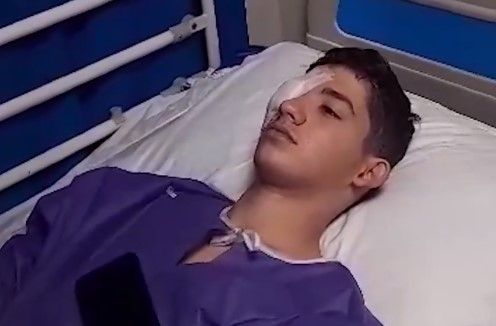 شلیک ماموران به یک نوجوان، ۱۶ ماه پس از خیزش انقلابی او را نابینا کرد