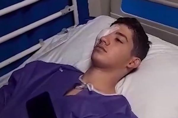 مراهق إيراني يصاب بالعمى بعد 16 شهرا من إطلاق الشرطة عبوة غاز في وجهه أثناء الاحتجاجات