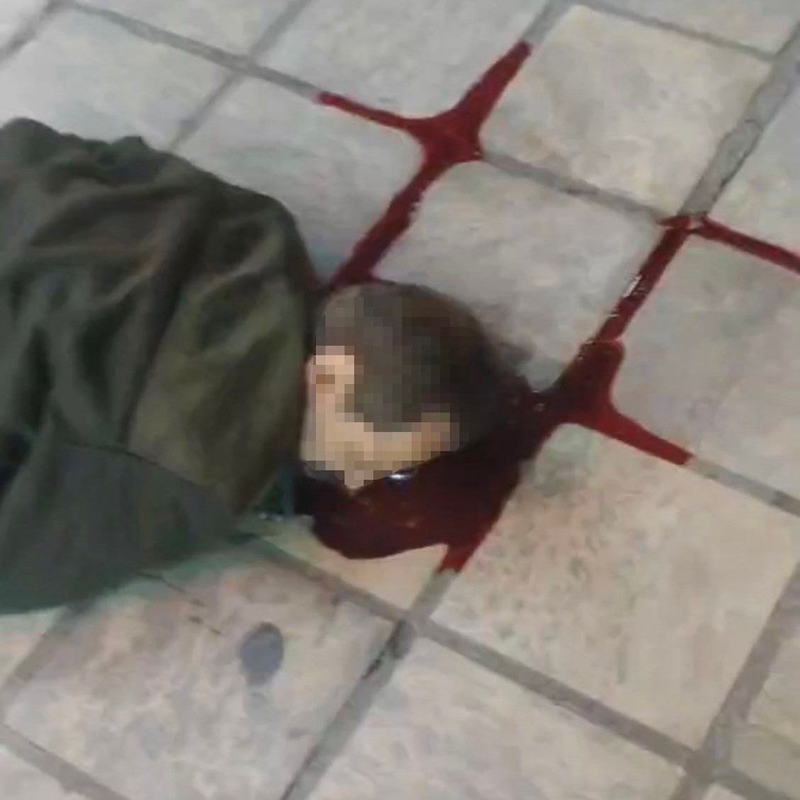 A protester hit in the head during protests  