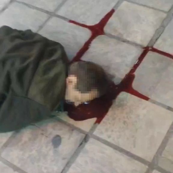 A protester hit in the head during protests