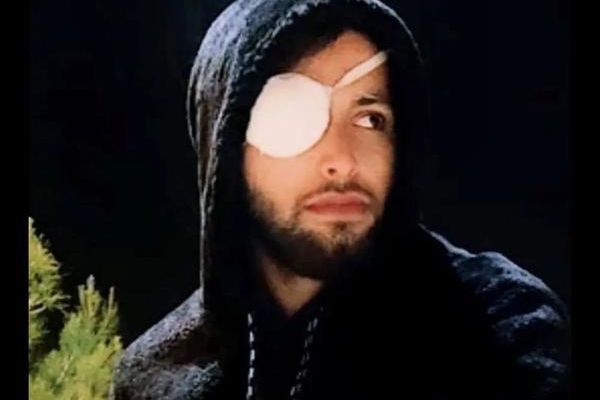 Iranian Protester Who Lost Eye In 2022 Protests Sentenced To Prison