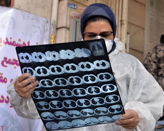 عضو کمیته علمی ستاد مقابله با کرونا: مواردی از ابتلا به قارچ سیاه در تهران مشاهده شده است