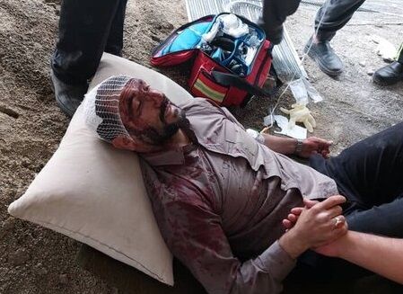 پزشکی قانونی: مقام شهرداری که گفته بود در حمله خلافکاران مجروح شده احتمالا خودزنی کرده