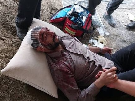 پزشکی قانونی: مقام شهرداری که گفته بود در حمله خلافکاران مجروح شده احتمالا خودزنی کرده