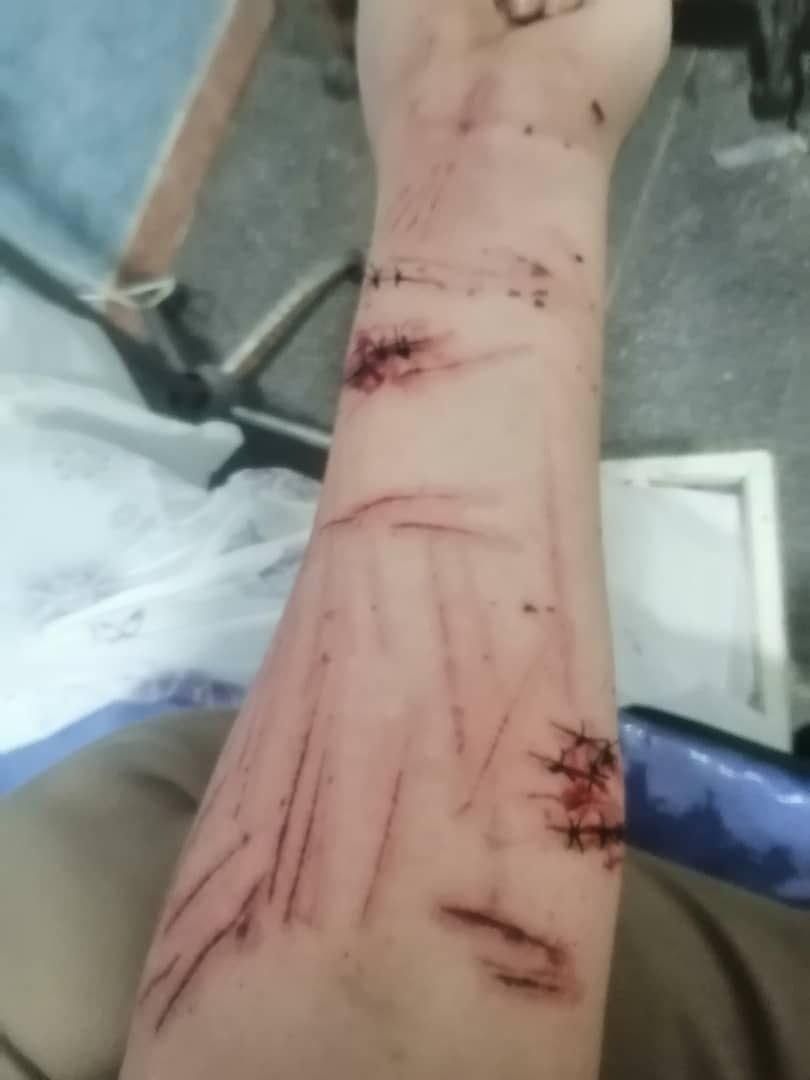 Photo of what appears to be a knife attack during the ceremony of rights lawyer Khosrow Alikordi. 